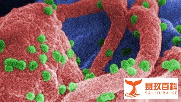 全球首例感染艾滋病痊愈女患者诞生 系首次使用干细胞移植方法