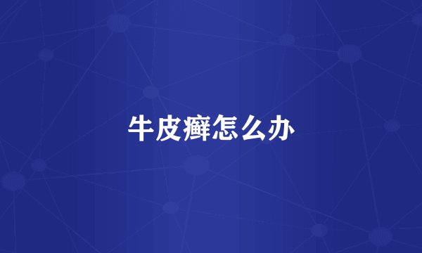 牛皮癣怎么办