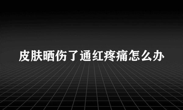 皮肤晒伤了通红疼痛怎么办