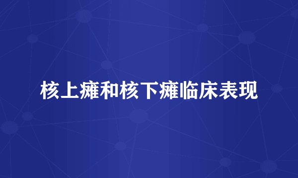 核上瘫和核下瘫临床表现