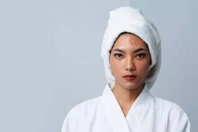 脸上长色斑该怎么办