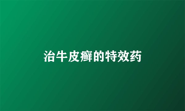 治牛皮癣的特效药