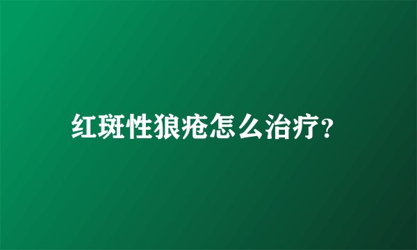 红斑性狼疮怎么治疗?