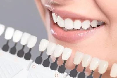 冷光牙齿的美白效果好吗 冷光美白牙齿三大优势要了解
