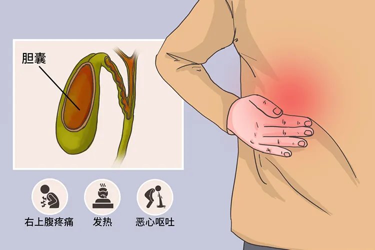 男士胆囊炎症状疼痛位置图