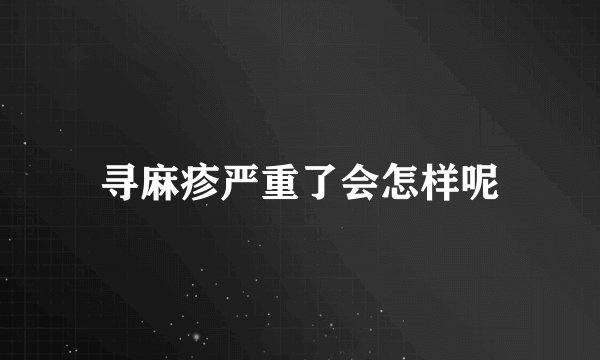 寻麻疹严重了会怎样呢