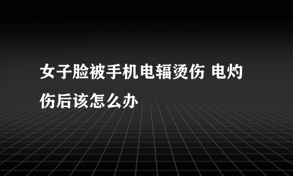 女子脸被手机电辐烫伤 电灼伤后该怎么办