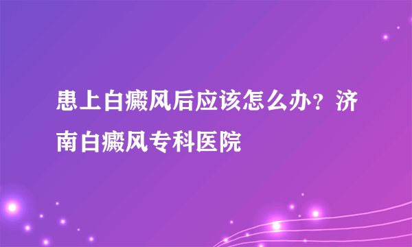患上白癜风后应该怎么办？济南白癜风专科医院