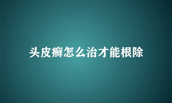 头皮癣怎么治才能根除