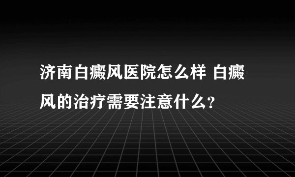 济南白癜风医院怎么样 白癜风的治疗需要注意什么?