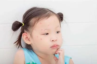 宝宝脸上长小红疙瘩怎么办