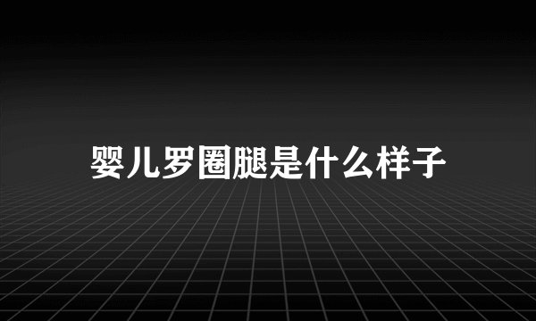 婴儿罗圈腿是什么样子