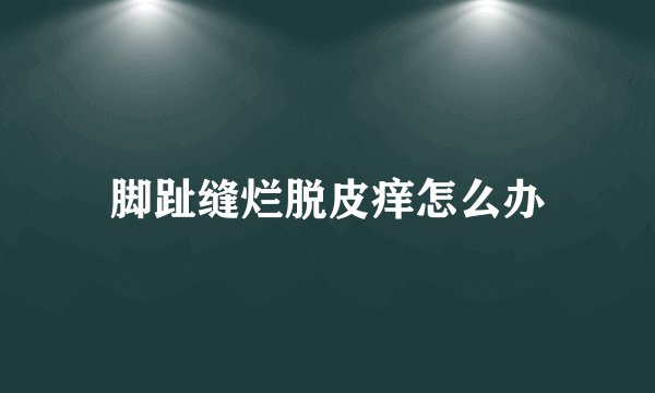 脚趾缝烂脱皮痒怎么办