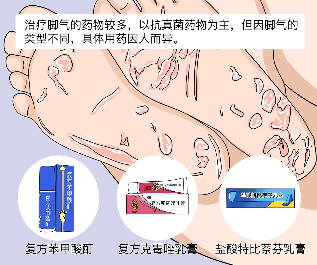 治疗脚气的药有哪些