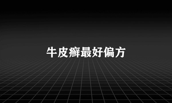 牛皮癣最好偏方