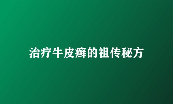 治疗牛皮癣的祖传秘方