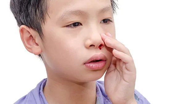 流鼻血止不住怎么办