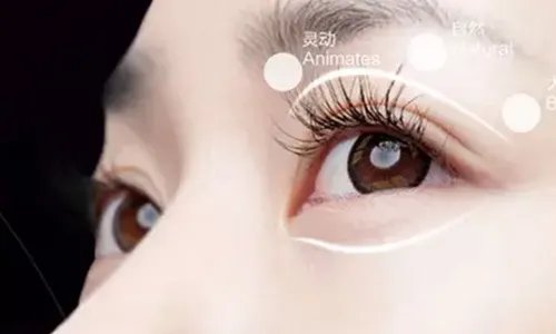 北京割双眼皮的价格大概是多少啊