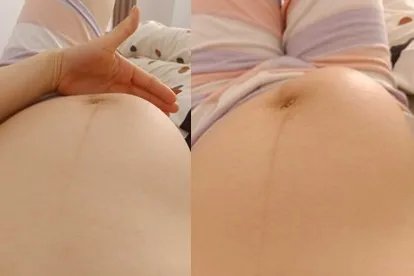 胎动图片