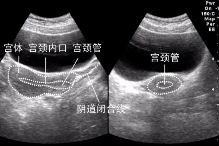 健康子宫图片