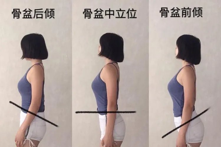 骨盆前倾和后倾的区别图片