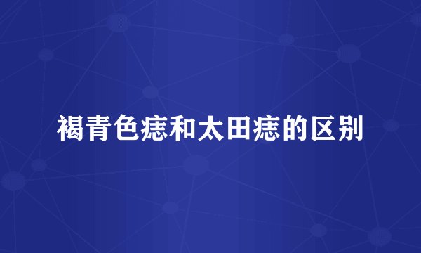 褐青色痣和太田痣的区别
