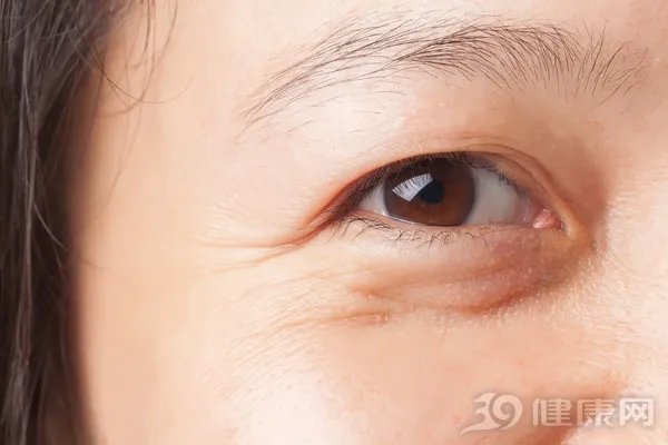 如何去除法令纹效果好？