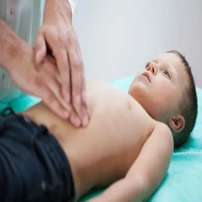 腹部体格检查需要注意什么