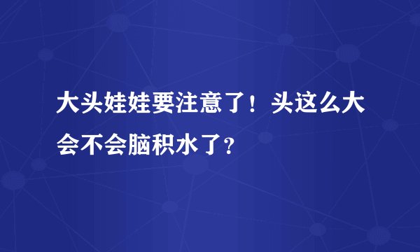 大头娃娃要注意了！头这么大会不会脑积水了？