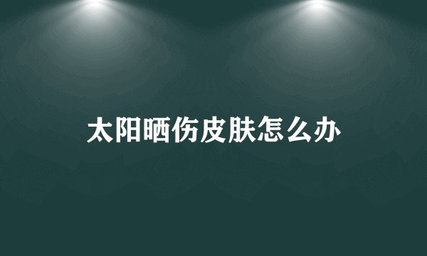 太阳晒伤皮肤怎么办