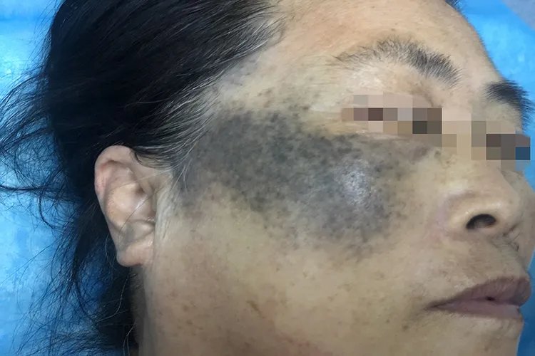女性长斑的位置图解