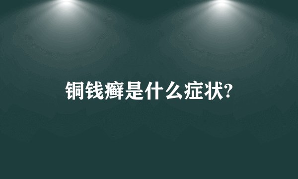 铜钱癣是什么症状?
