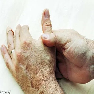 大拇指疼的原因有哪些 大拇指疼的3个原因要清楚