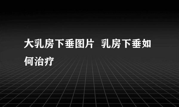 大乳房下垂图片 乳房下垂如何治疗