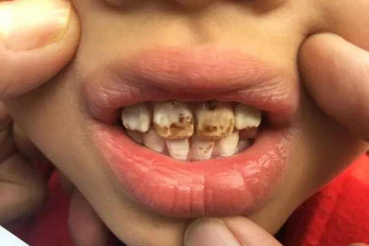 难看的牙齿图片大全