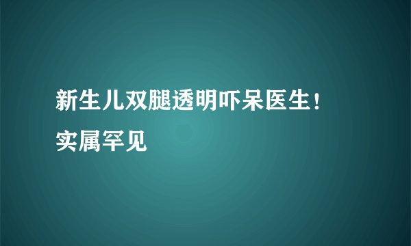 新生儿双腿透明吓呆医生! 实属罕见