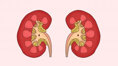 肾肿瘤怎么分类