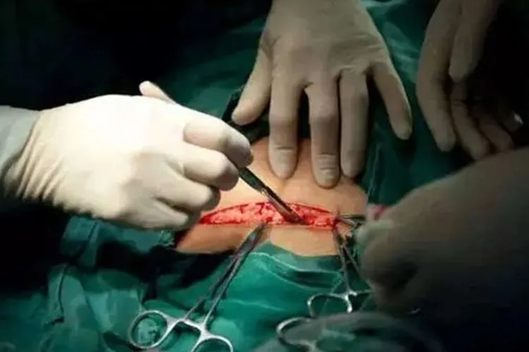 剖腹产图片