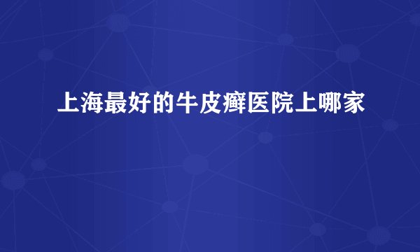 上海最好的牛皮癣医院上哪家