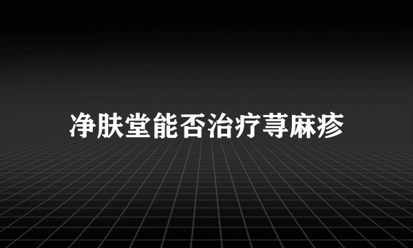 净肤堂能否治疗荨麻疹