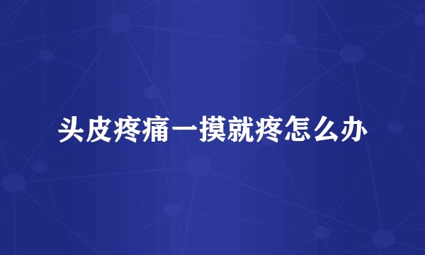 头皮疼痛一摸就疼怎么办