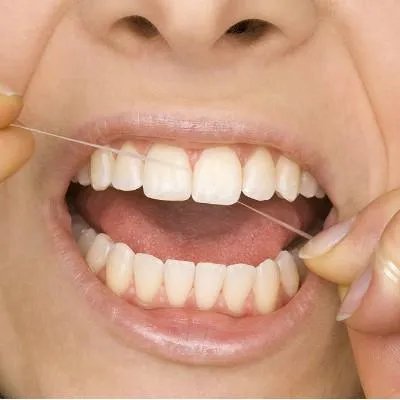 洗牙要多少钱