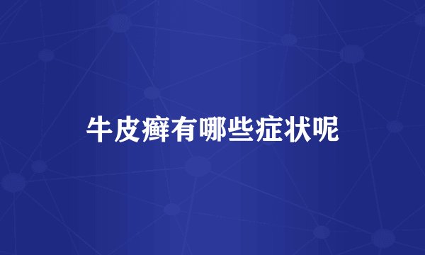 牛皮癣有哪些症状呢
