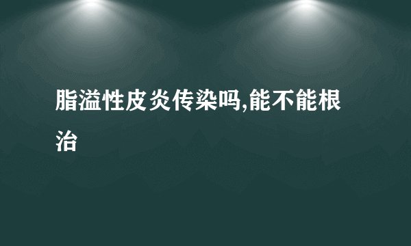 脂溢性皮炎传染吗,能不能根治