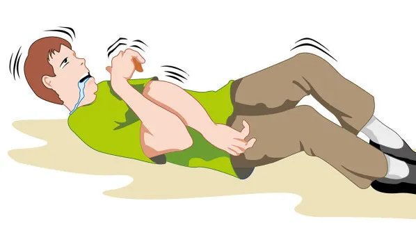 癫痫病的症状