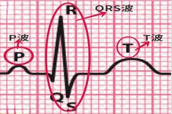 心电图符号