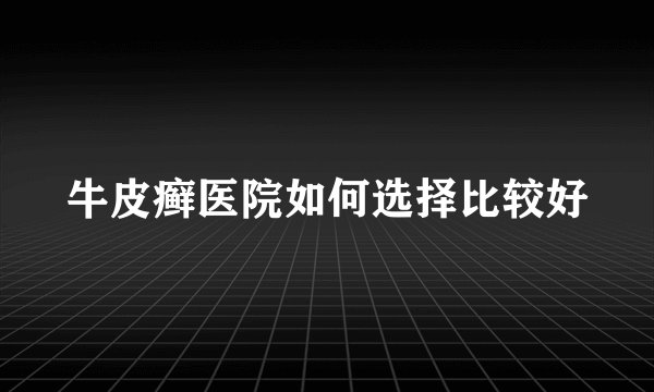 牛皮癣医院如何选择比较好