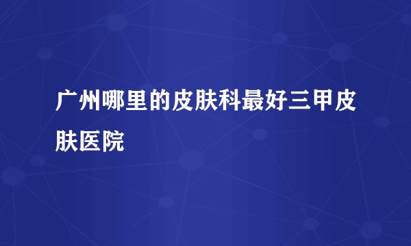 广州哪里的皮肤科最好三甲皮肤医院