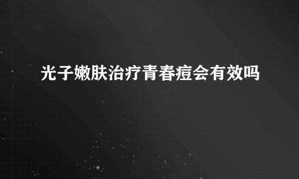 光子嫩肤治疗青春痘会有效吗