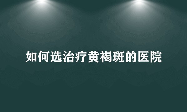 如何选治疗黄褐斑的医院